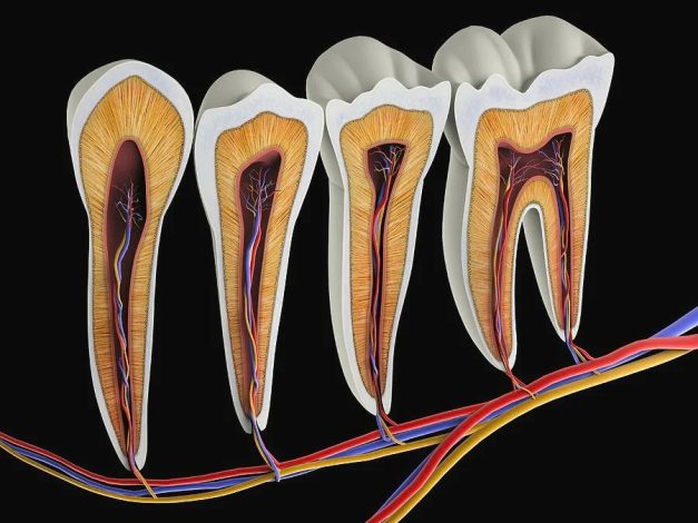 Видалення нерва зуба: коли та як проводиться процедура