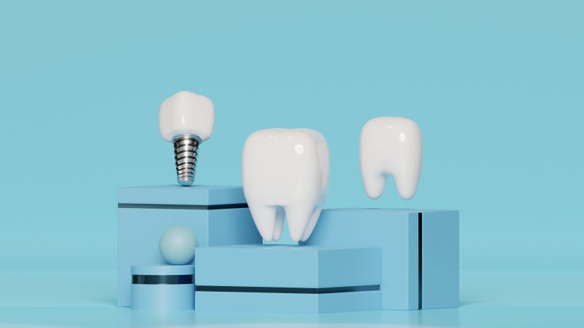 Зубні імпланти MegaGen