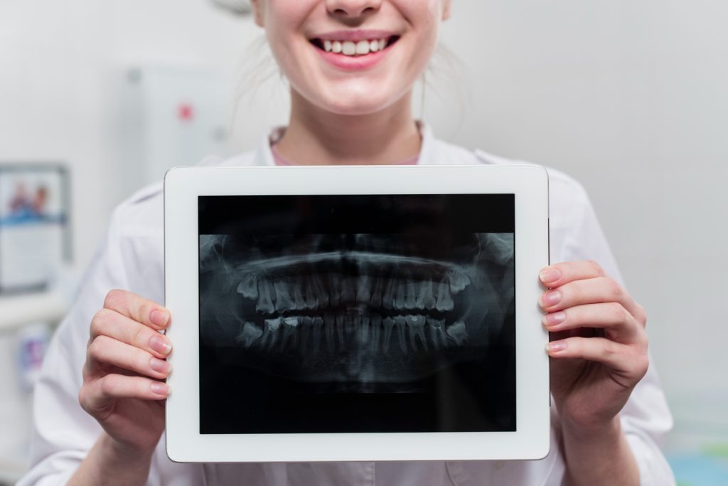Рентген зуба: ціна та показання до проведення