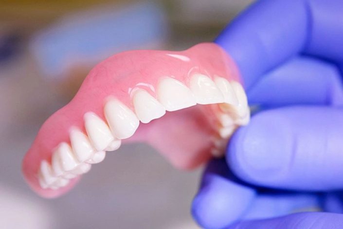 Що таке протезування зубів: різноманіття методів реставрації зубного ряду