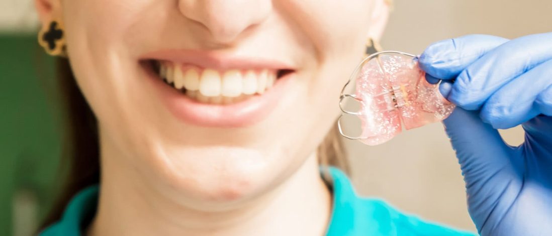Як вирівняти зуби без брекетів: альтернативні методи та їхня ефективність